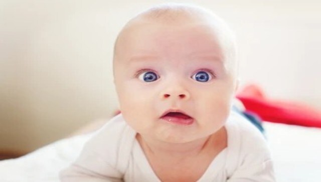 A 7.3 kg baby was born in Brazil. It's because of macrosomia: What is this condition?
