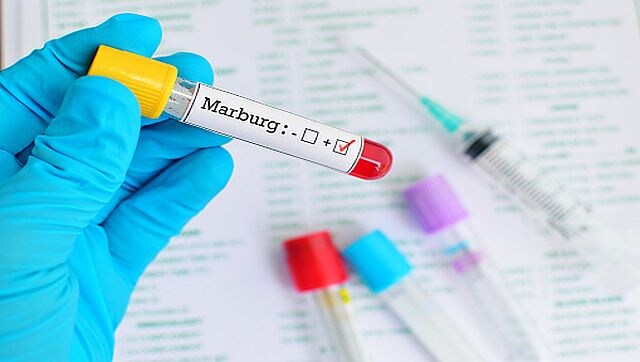 Equatorial Guinea confirms 13 cases of Marburg disease after WHO comments