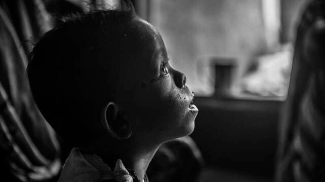 In India, how the crippling reality of severe malnutrition stems from religion and caste-based politics In India, how the crippling reality of severe malnutrition stems from religion and caste-based politics