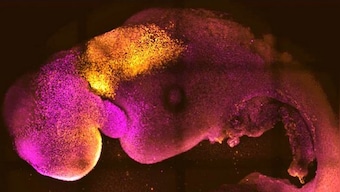 How scientists grew the world's first 'synthetic' embryo without eggs or sperm
