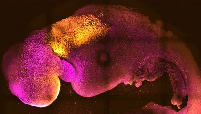 How scientists grew the world's first 'synthetic' embryo without eggs ...