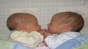Brazilian woman gives birth to twins with different biological fathers, here's how