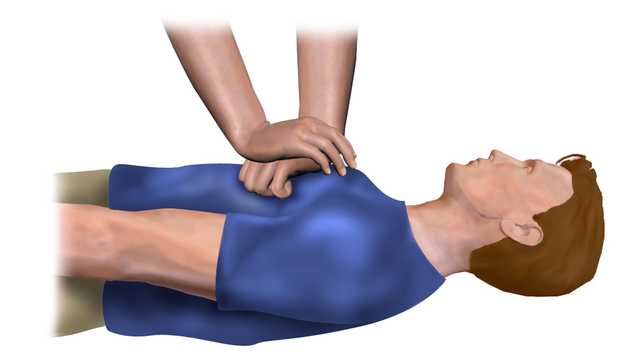 World Heart Day 2022: Why CPR is a life-saving skill to help a cardiac arrest patient World Heart Day 2022: Why CPR is a life-saving skill to help a cardiac arrest patient