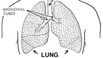 Why rehabilitation post lung transplant is critical to ensure optimum success of procedure
