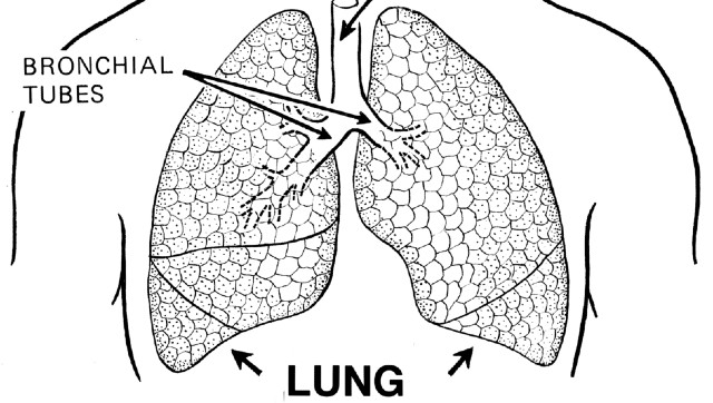 Why rehabilitation post lung transplant is critical to ensure optimum success of procedure Why rehabilitation post lung transplant is critical to ensure optimum success of procedure