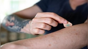 Get Inked! Welcome to the world of pain-free, blood-free tattoos