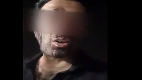 Mahsa Amini death: Iranian man shot in the face with pellet bullets urges people to hit streets, seek gender equality