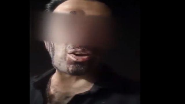 Mahsa Amini death: Iranian man shot in the face with pellet bullets urges people to hit streets, seek gender equality Mahsa Amini death: Iranian man shot in the face with pellet bullets urges people to hit streets, seek gender equality