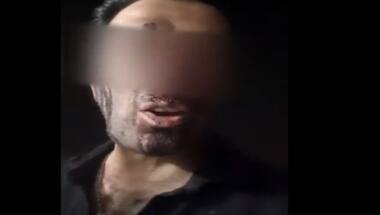 Mahsa Amini death: Iranian man shot in the face with pellet bullets urges people to hit streets, seek gender equality