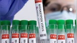 Monkeypox reaches China: 'Don't touch foreigners,' says China's top health official to avoid infection