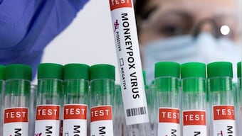 China reports its first monkeypox case in Chongqing city