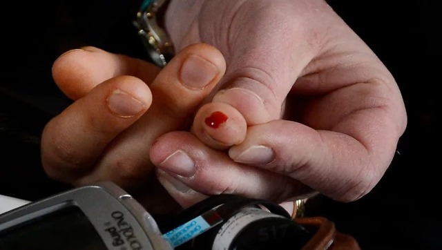 From blurry vision to extreme hunger: The lesser-known symptoms of diabetes From blurry vision to extreme hunger: The lesser-known symptoms of diabetes