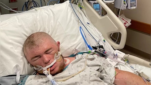 Ohio man escapes death after getting stung '20,000 times' by bees