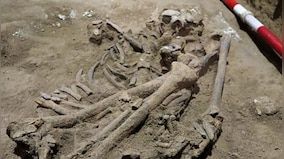 Did amputations occur 31,000 years ago? What a new skeleton reveals?