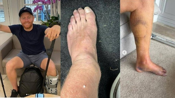England batter Jonny Bairstow out until 2023 after breaking leg in golf accident