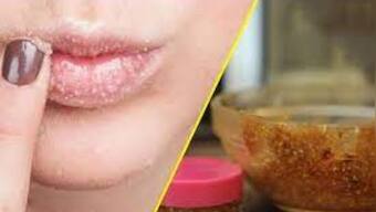 Follow these tips this winter for soft and healthy lips
