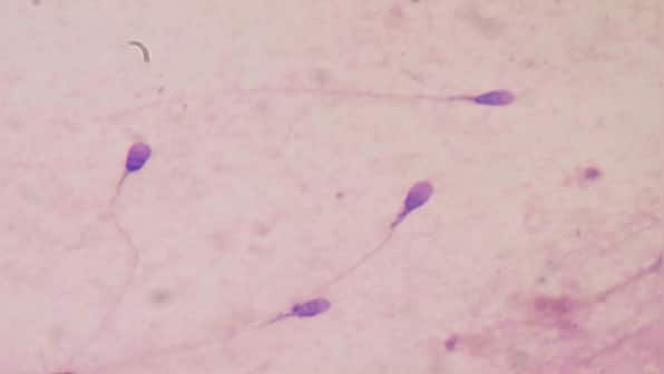 A bleak future for mankind: Why is there a significant decline in sperm count globally including India?
