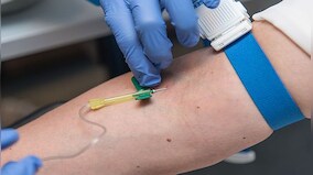 A Medical Marvel? A new blood test that can detect all cancers at the same time