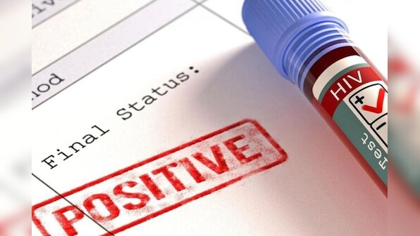 World AIDS Day 2022: How to reduce risk of HIV transmission during sex