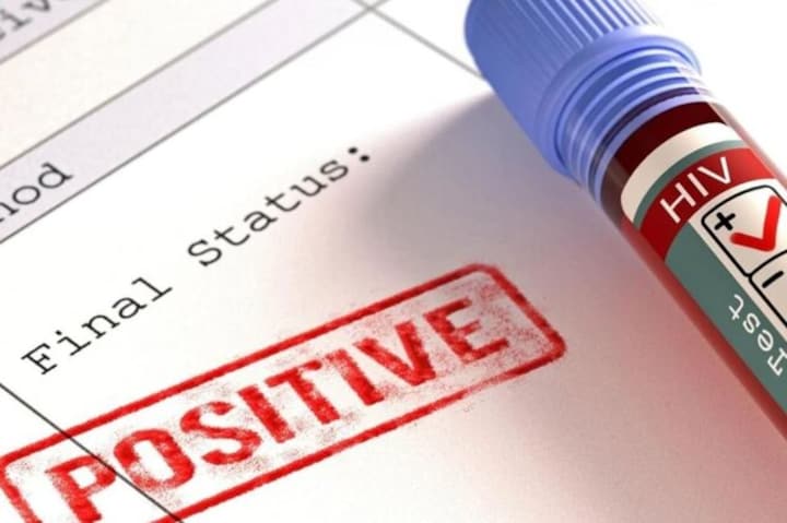 World AIDS Day 2022: How to reduce risk of HIV transmission during sex