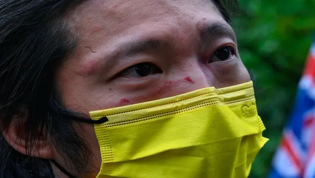 Britain defends measured response to Chinese diplomats roughing up Hong Kong protester in Manchester consulate Britain defends measured response to Chinese diplomats roughing up Hong Kong protester in Manchester consulate