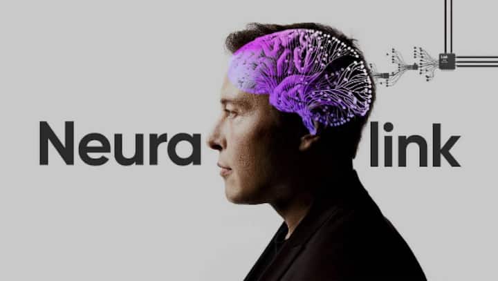 Elon Musk's Neuralink: Two neurosurgeons weigh in on the feasibility of Musk's brain implant and its potential Elon Musk's Neuralink: Two neurosurgeons weigh in on the feasibility of Musk's brain implant and its potential