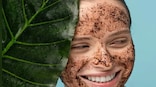 Five home remedies for healthy skin in winter