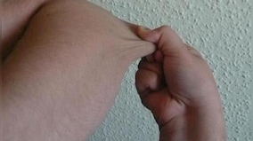 How skin can be a potential indicator for lung diseases