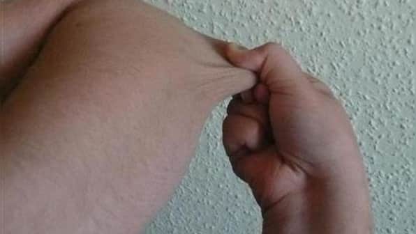 How skin can be a potential indicator for lung diseases