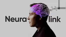 What is Neurotechnology and Brain-Computer Interface, the tech that Elon Musk’s Neuralink uses?