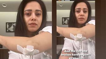 Nushrratt Bharuccha shares pictures from Chhorii 2 sets, says, 'Cuts and bruises have begun'
