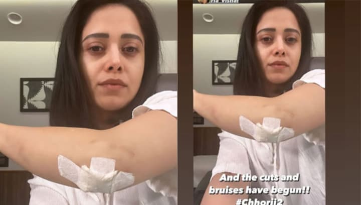 Nushrratt Bharuccha shares pictures from Chhorii 2 sets, says, 'Cuts and bruises have begun'