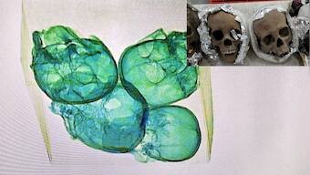 Mexico: Authorities stumble on package containing human skulls en route to US