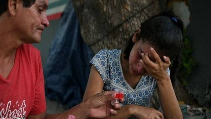 WHO recommends to not use two India-based cough syrups in Uzbekistan