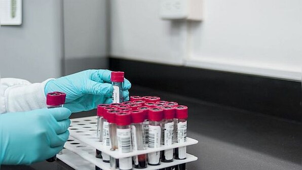 How COVID-19 negatively impacts sperm quality in men