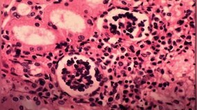 Neglected Tropical Diseases: How community level awareness can help reduce vulnerability