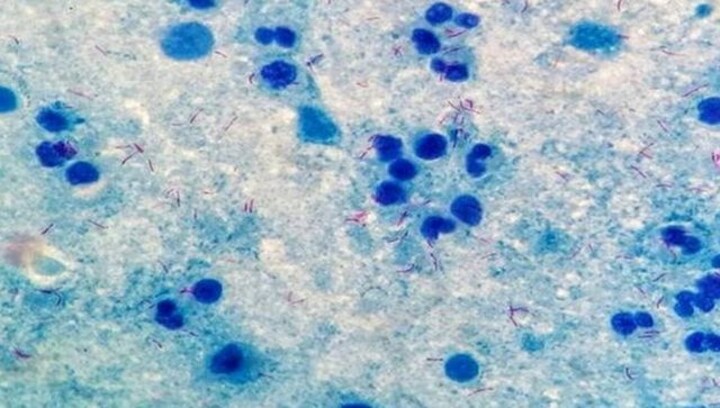 Ebola-Like virus kills nine in Equatorial Guinea, WHO Dispatches Teams