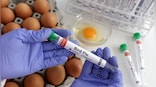 Bird flu is spreading: Is this a foreboding of the next pandemic?