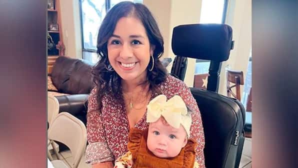 US: 29-year old woman’s limbs amputated after septic shock following childbirth