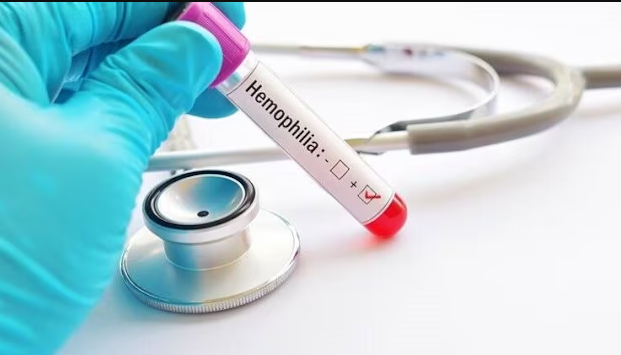 How Hemophilia patients can find relief through correct strategy How Hemophilia patients can find relief through correct strategy