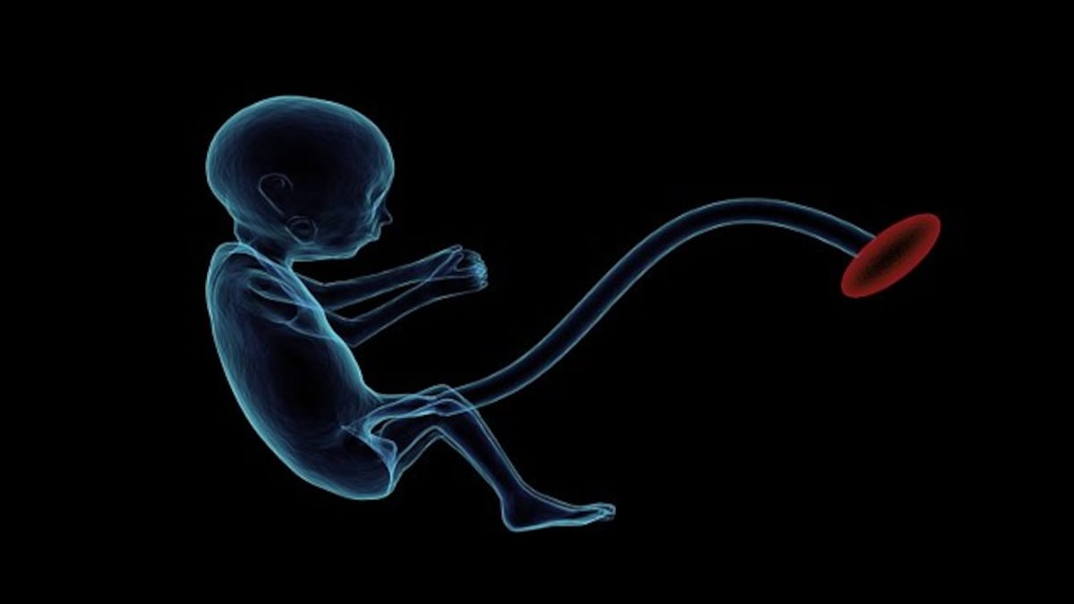 How a 'parasitic unborn twin' was found in a one-year-old girl's brain in China