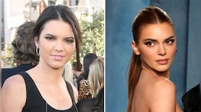 Kendall Jenner hit with fresh 'plastic surgery' rumours; fans believe her looks have 'changed'