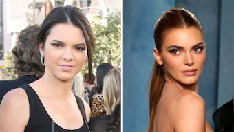 Kendall Jenner hit with fresh 'plastic surgery' rumours; fans believe her looks have 'changed'