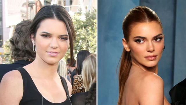 Kendall Jenner hit with fresh 'plastic surgery' rumours; fans believe her looks have 'changed' Kendall Jenner hit with fresh 'plastic surgery' rumours; fans believe her looks have 'changed'