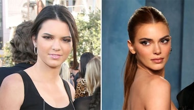 Kendall Jenner hit with fresh 'plastic surgery' rumours; fans believe her looks have 'changed'