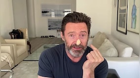 Hugh Jackman is urging people to wear sunscreen: Can it prevent skin cancer?