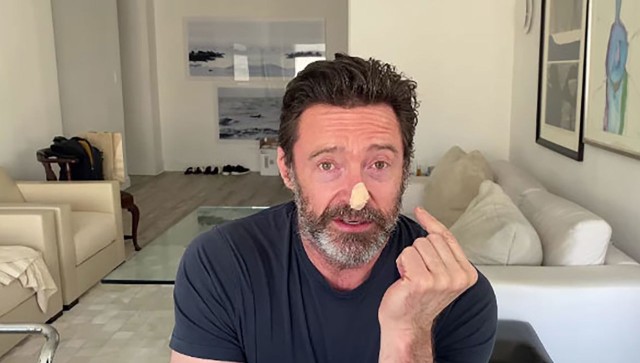 Hugh Jackman is urging people to wear sunscreen: Can it prevent skin cancer? Hugh Jackman is urging people to wear sunscreen: Can it prevent skin cancer?
