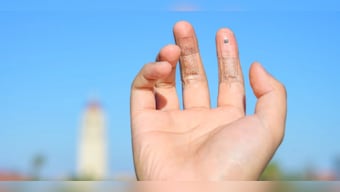 Explained: E-skin invented by scientists that mimics our sense of touch