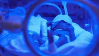 ‘Silent emergency’: Preterm complications claim a million lives yearly