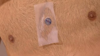 Novak Djokovic dons mysterious Iron Man-like chip on chest: What is it and how does it help?